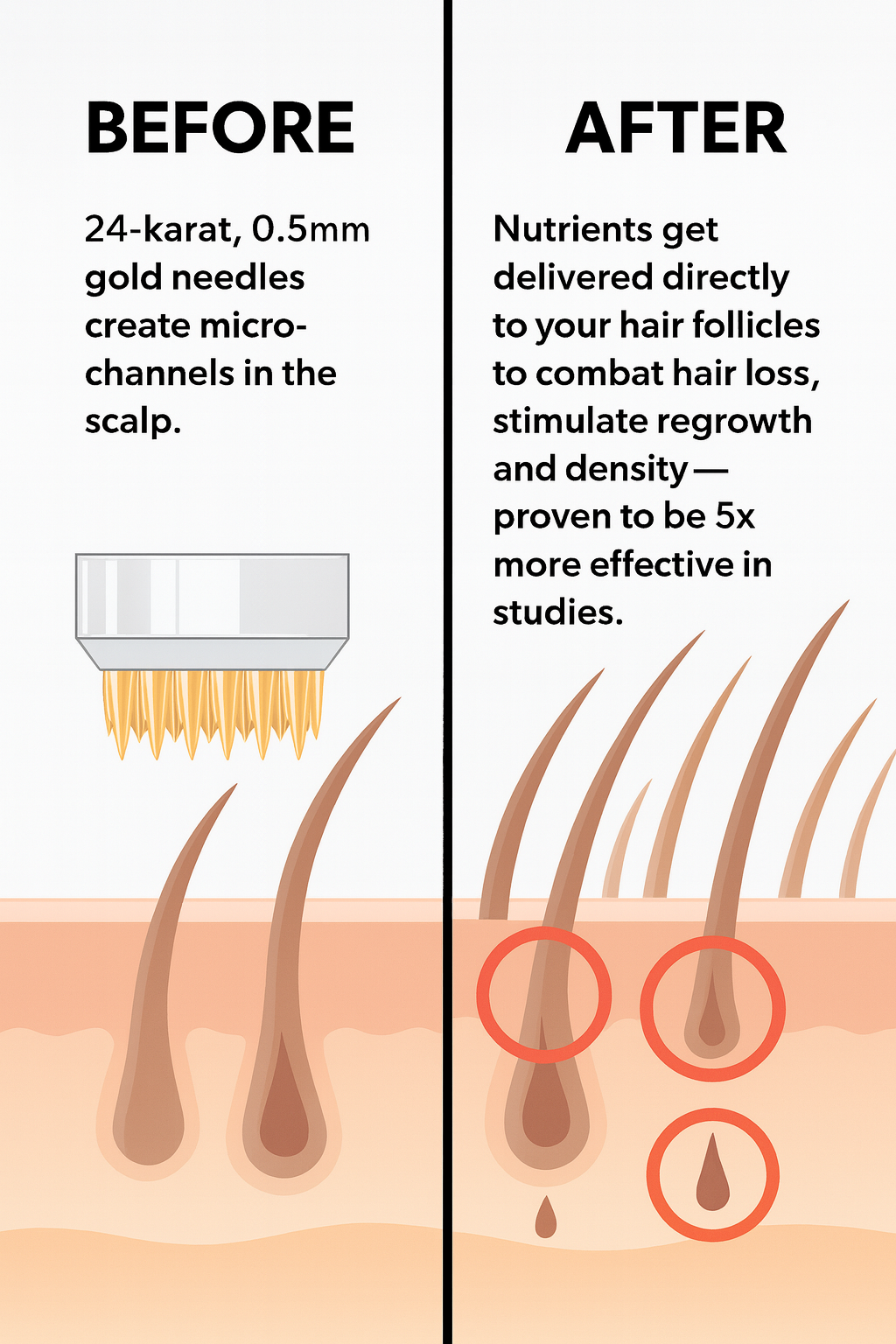 NoveosLab™ - Microneedle Hair Regrowth Kit